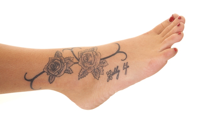 Ink Blasters Precision Laser Tattoo Removal in Metro Detroit