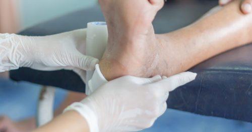 Prevention, treatment offer hope for diabetic foot ulcers