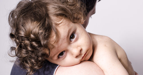 young boy with measles being comforted by father