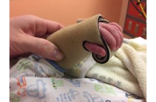 Child's hand in infant-sized splint