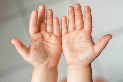 a pair of children's hands palms up