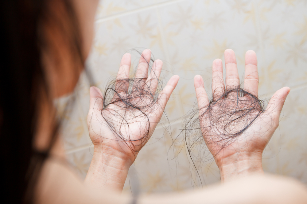 Why is my hair falling out? | OSF HealthCare