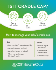 cradle cap, managing baby's cradle cap, what is cradle cap